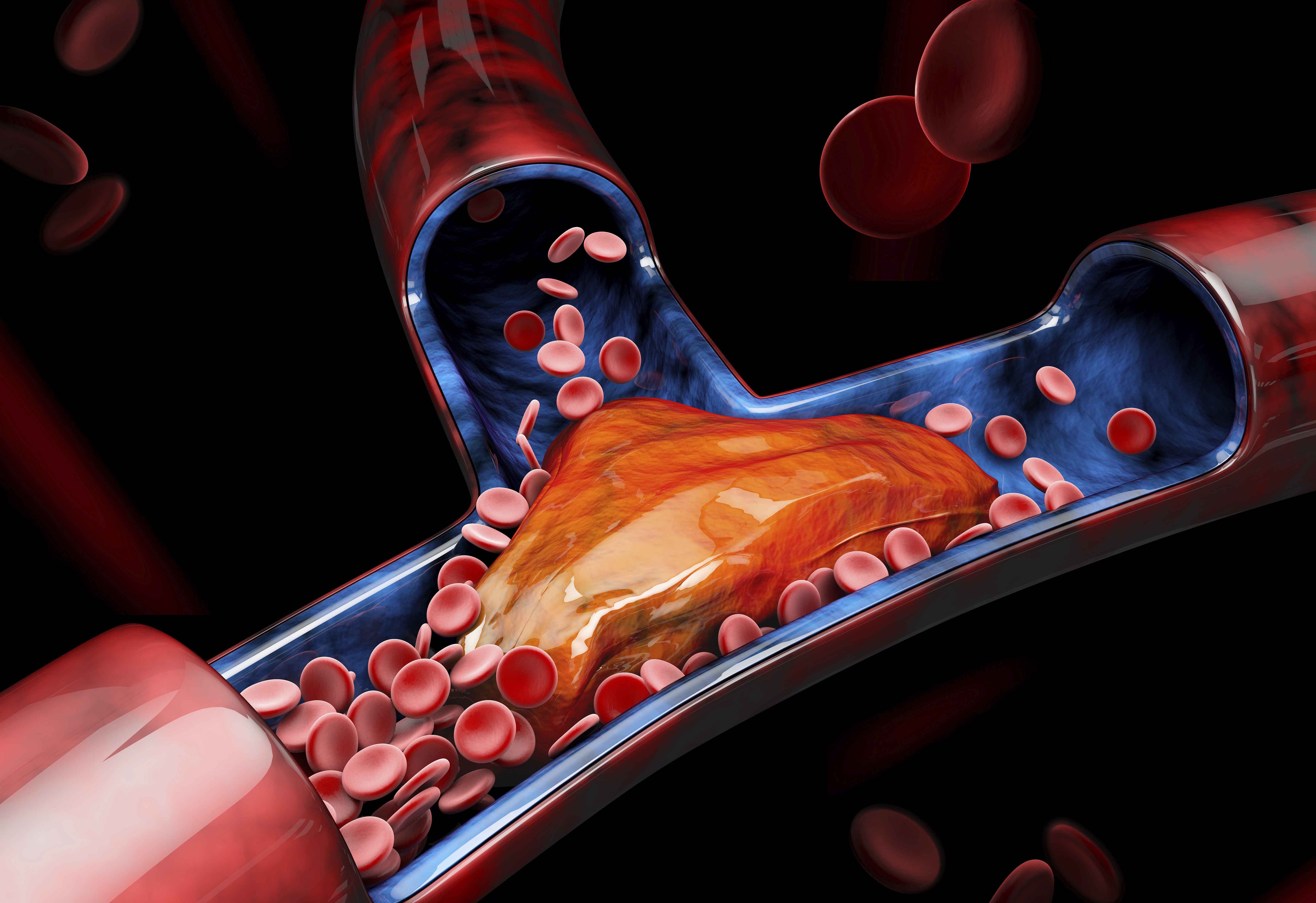 Custom Software Development